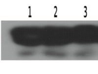 eIF2-alpha | Eukaryotic translation initiation factor 2 subunit alpha in the group Antibodies Plant/Algal / DNA/RNA/Cell Cycle / Translation at Agrisera AB (Antibodies for research) (AS20 4371)